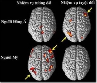 Văn hóa ảnh hưởng đến chức năng của não